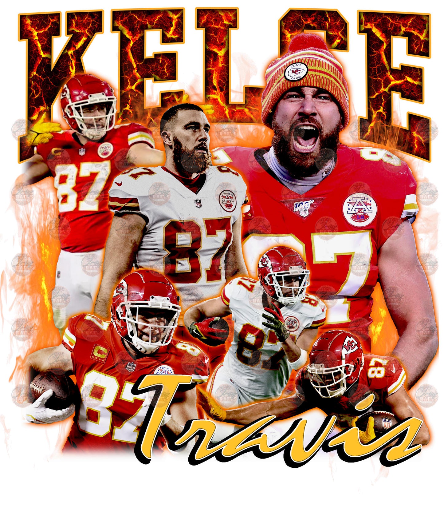 87 Is On Fire Transfer